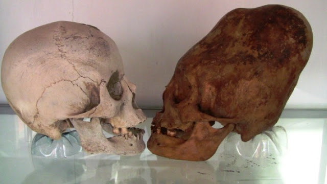 Archaeologists in Bolivia Found Two Skeletons With Abnormally Elongated Skulls