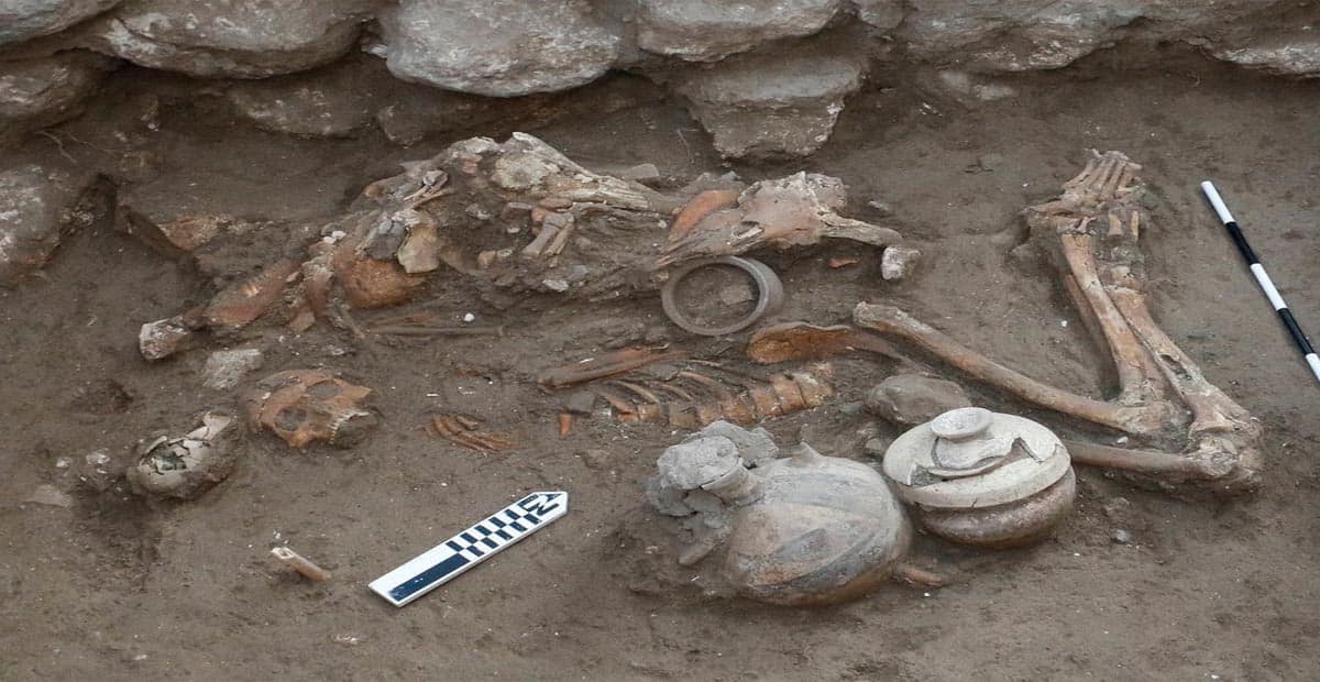 Archaeologists believe that a distinguished Bronze Age man who underwent brain surgery 3,500 years ago may have had leprosy