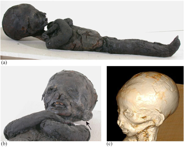 Child Mummies Show High Rates Of Anemia