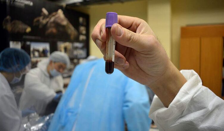 Scientists Extracted Liquid Blood From 42,000-Year-Old Foal Found in Siberian Permafrost