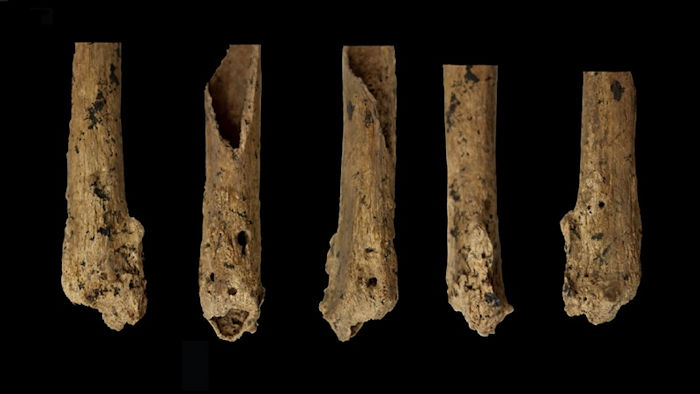 31,000-Year-Old Skeleton Missing Foot May Show Oldest Amputation