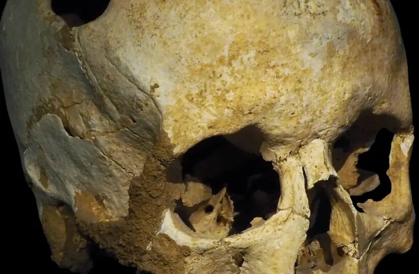 3,200-Year-Old Trepanned Skull Unearthed in Eastern Turkey’s Van Province