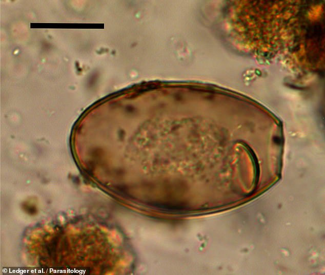 Unveil History of Worm Parasites in Britain