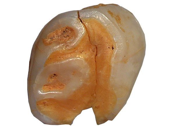 Neanderthal Baby Teeth Reveal Weaning Patterns 