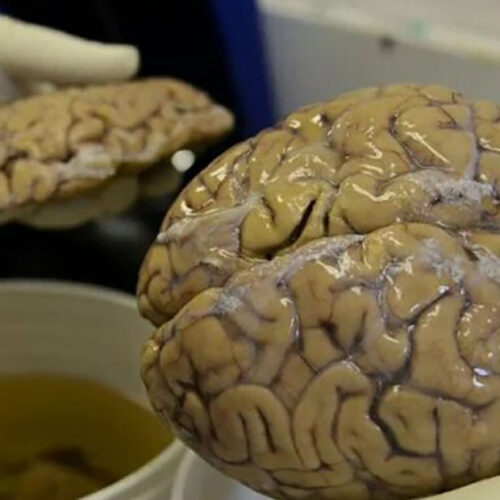 Old Brain Discovered in England: The Iron Age