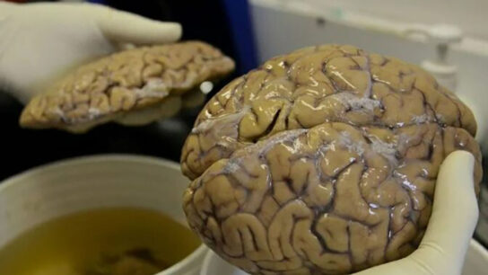 Old Brain Discovered in England: The Iron Age