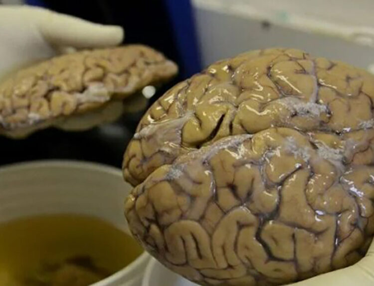 Old Brain Discovered in England: The Iron Age