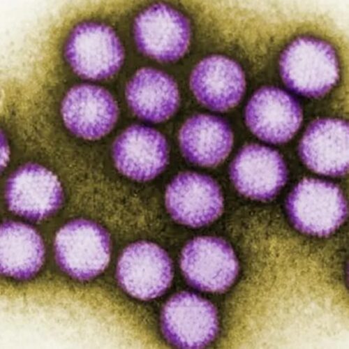 Oldest Known Human Viruses Discovered In 50,000-year-old Neanderthal Remains