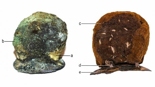 300-Year-Old “Exceptional” Gold and Copper Prosthesis Discovered in Poland